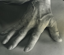 Marion Rosen's hand